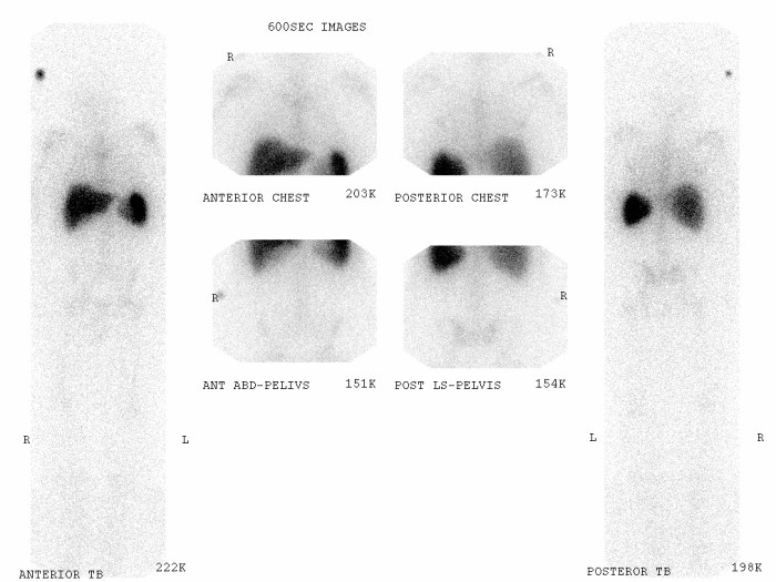 Blood cells imaging