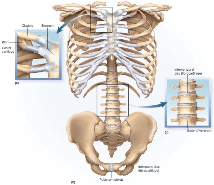 Drag the labels to identify synovial joints